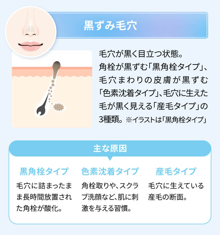 毛穴ケア　ピーリング　美容液　選び方