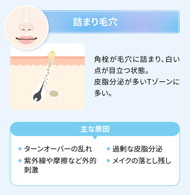毛穴用ピーリング　美容液　選び方